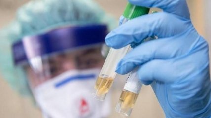 В Україні 56 нових підозр на коронавірус