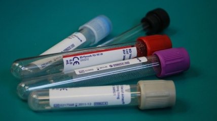 У Нідерландах за добу виявили 1159 нових випадків коронавірусу