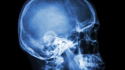 Превзошли все ожидания: новые наночастицы уменьшают отек мозга при травмах головы