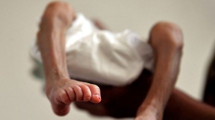 Четверть детей в мире страдают от недоедания