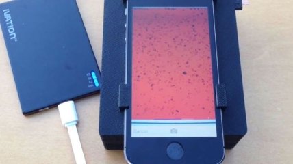 С помощью iPhone научились диагностировать наличие паразитов в крови