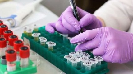 На Буковине зафиксировано еще 47 случаев коронавируса