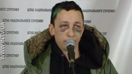 Активист рассказал, как "Беркут" избивал автомайдановцев