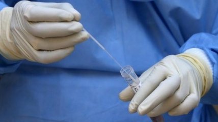 Першу в світі вакцину, що вбиває коронавірус розробили в Італії