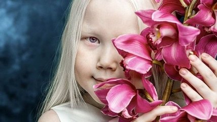 8-летняя девочка-альбинос, поразившая модельные агентства своей красотой (Фото) 