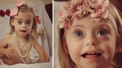 2-летняя девочка с синдромом Дауна стала моделью благодаря своей улыбке (Фото)