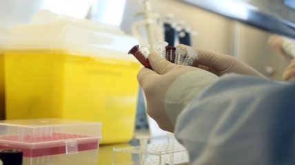 Российскую вакцину против ВИЧ-СПИД испытают на людях  
