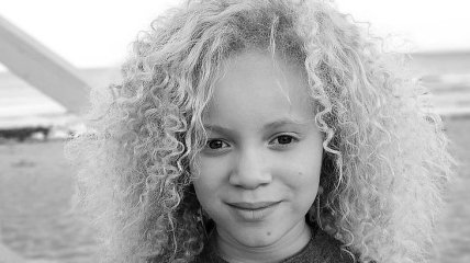 Маленькая девочка-альбинос покорила модный мир необычной красотой (Фото) 