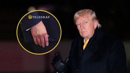 Дональд Трамп знову ховає синці на руках