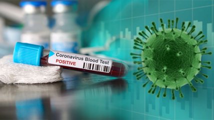 В Украине рекордно упала недельная заболеваемость коронавирусом: свежие данные на 23 мая