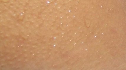 Ученые создали уникальный пластырь для пересадки кожи