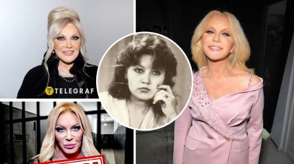 Таисия Повалий не скрывает, что делает пластику и "уколы красоты"