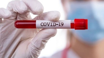 У Росії кількість хворих на COVID-19 перевищила 430 тисяч