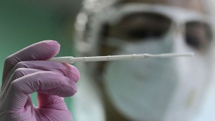 Число больных коронавирусом в Украине впервые за месяц опустилось ниже устоявшейся психологической отметки