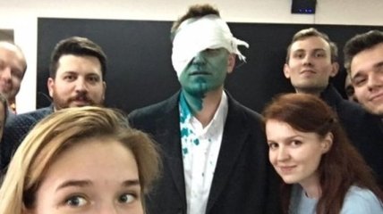 Навальному плеснули в лицо зеленкой, политик госпитализирован