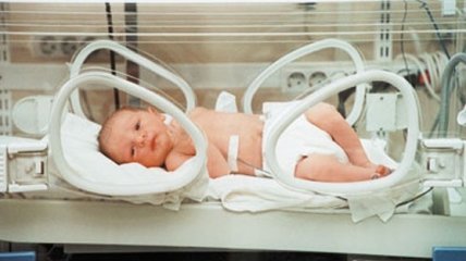 Недоношенный малыш: как выхаживают детей, рожденных раньше срока