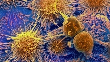 Ученые превратили водоросли в убийц раковых клеток