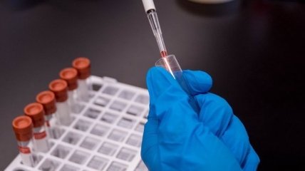 Тест на коронавирус можно будет бесплатно сдать в частной лаборатории: что решил Кабмин
