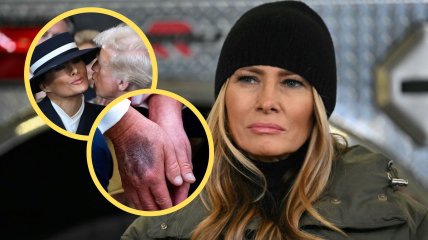 Некоторые привилегии Мелания потеряет сразу, если Трамп внезапно умрет