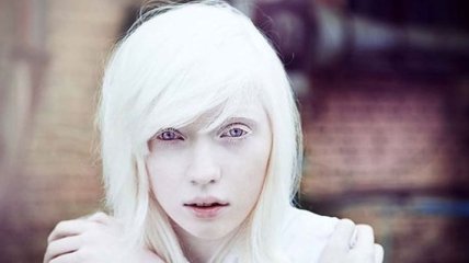 Не такие как все: люди-альбиносы (Фото)