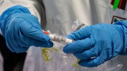 На Буковине зафиксировали еще 47 случаев коронавируса