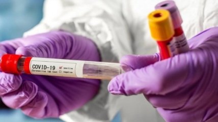 Майже в два рази менше нових заражень на коронавірус зафіксували в Україні: свіже зведення