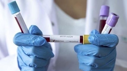 У Радомишлі ізолювали 22 людей, які контактували з інфікованою коронавірусом