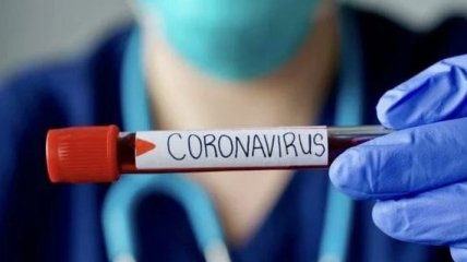 На Київщині вже підтвердили 140 випадків коронавірусу