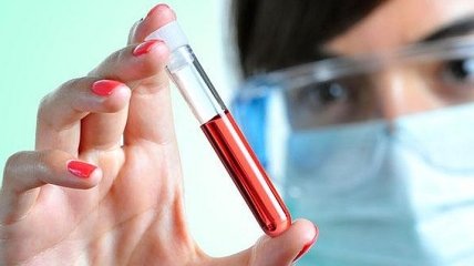 Обнаружена зависимость между группой крови и мужской потенцией