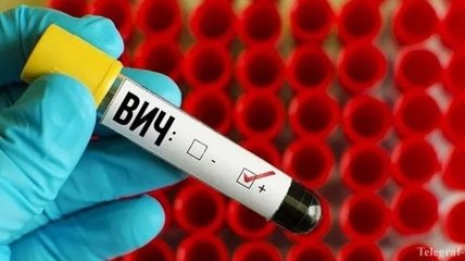 Коронавирус в США может привести к вспышке ВИЧ-инфекции