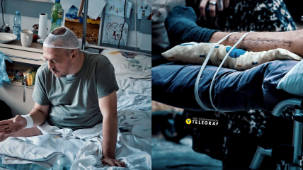 Каждый день украинцы получают ранения