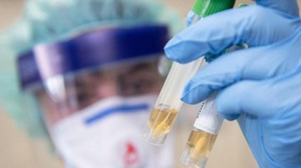 В Україні дослідили 20 зразків на коронавірус, жодну підозру не підтвердили