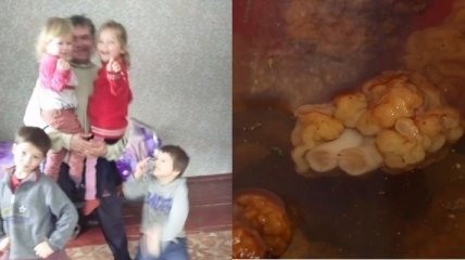 Ели мамин суп: на Черниговщине дети оказались на грани между жизнью и смертью