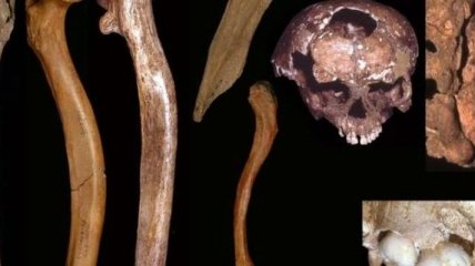 Ученые обнаружили аномалии развития у древних людей 