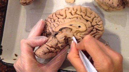 Ученые выяснили механизм формирования мозга у человека
