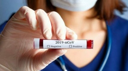 На Вінниччині 67 людей вилікувались від коронавірусу