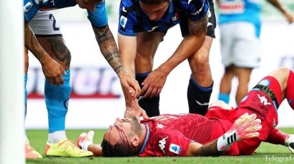 Ужасная травма Оспины и командный гол - в обзоре матча Аталанта - Наполи (Видео)