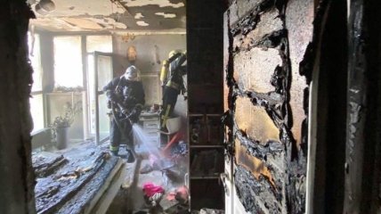 В Киеве десятилетняя девочка получила травмы, пытаясь потушить пожар в комнате