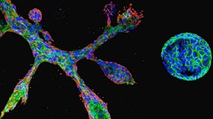 Ученым удалось штучно вырастить клетки молочной железы