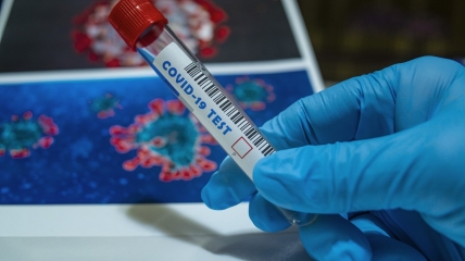 За минулу добу зробили 91 103 тести на коронавірус.