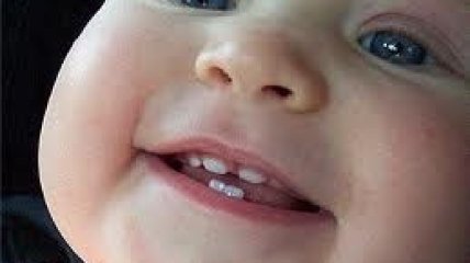 Что сделает зубы ребенка здоровыми?