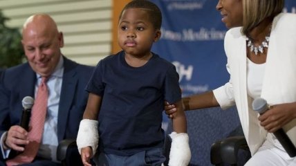 Восьмилетнему мальчику успешно пересадили кисти рук