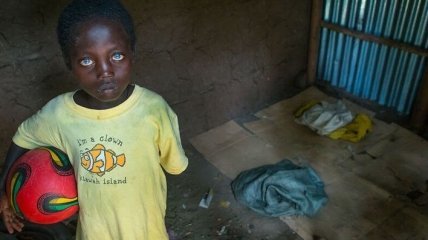 "Пластмассовые" глаза африканского мальчика, "подаренные" ему судьбой (Фото)