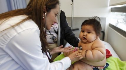 8-месячный малыш с ожирением весит 21 кг (фото+видео)