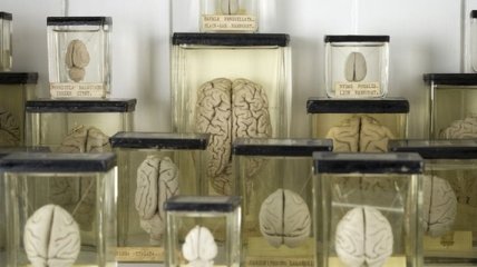 США: Из Техасского университета пропало 100 банок с мозгами
