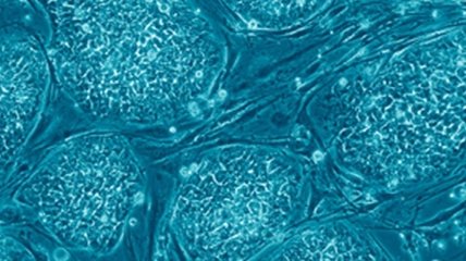 Чем обусловлены уникальные способности стволовых клеток?