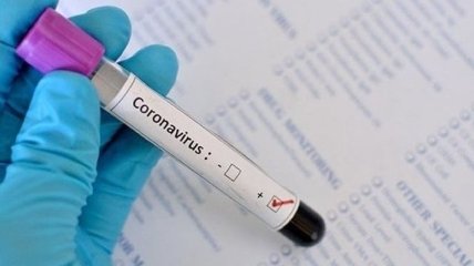 Медики наголошують, що тестування на коронавірус мають робити всі