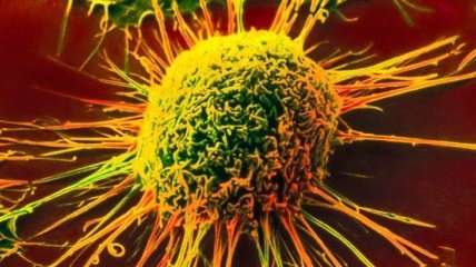 Ученые нашли эффективный способ борьбы с раком  