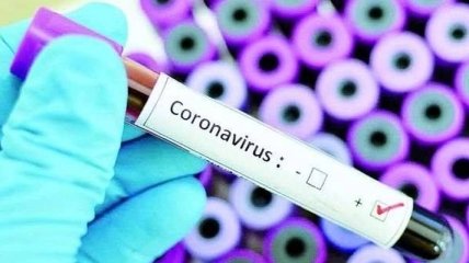 Коронавірус в Італії: українців серед інфікованих немає