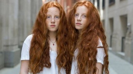 "Одинаковые, но непохожие": близнецы в удивительном фотопроекте (Фото) 